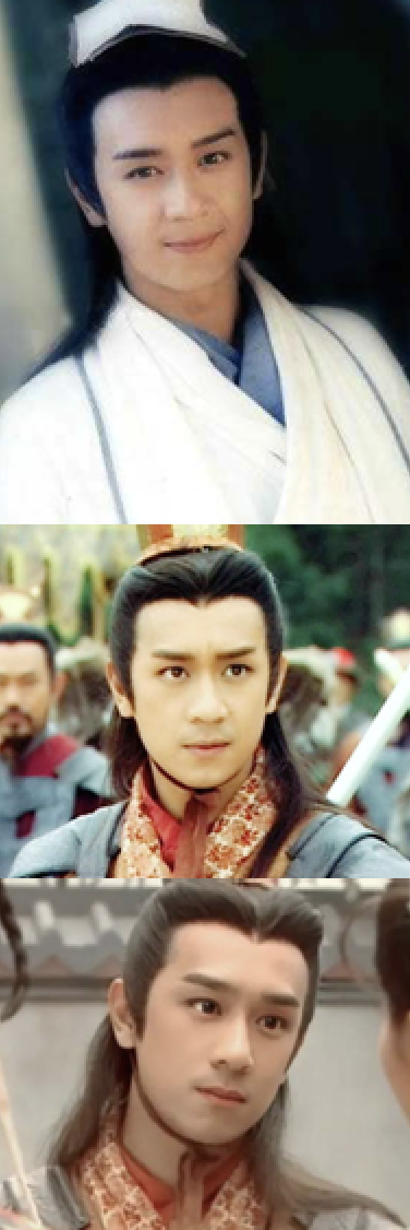 越整越難看後遺症一堆的男星：臉像鞋拔子，不能做表情，演戲難看