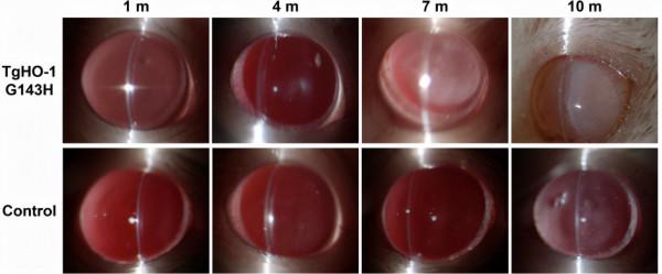 中國之聲丨李朝輝教授:如何系統性做好白內障的基礎研究? 中國之聲丨李朝輝教授:如何系統性做好白內障的基礎研究?