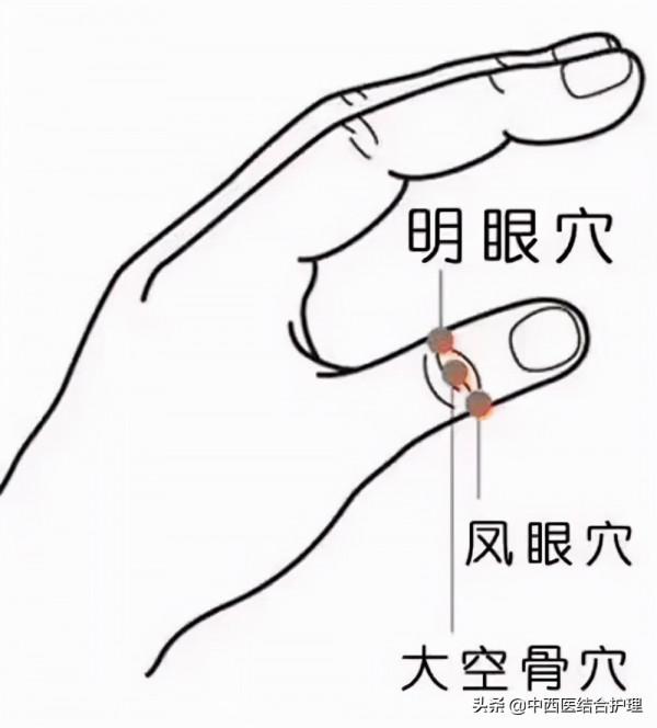 「穴位養生」生活小常識～眼睛疲勞有方法