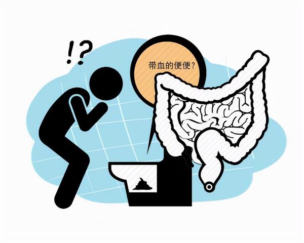 排便時出現這4個異常,勸你最好第一時間,做個癌症篩查 排便時出現這4個異常,勸你最好第一時間,做個癌症篩查