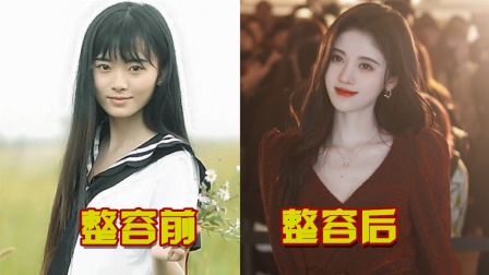 整容界的天花板!盤點靠整容實現逆天改命的明星 整容界的天花板!盤點靠整容實現逆天改命的明星