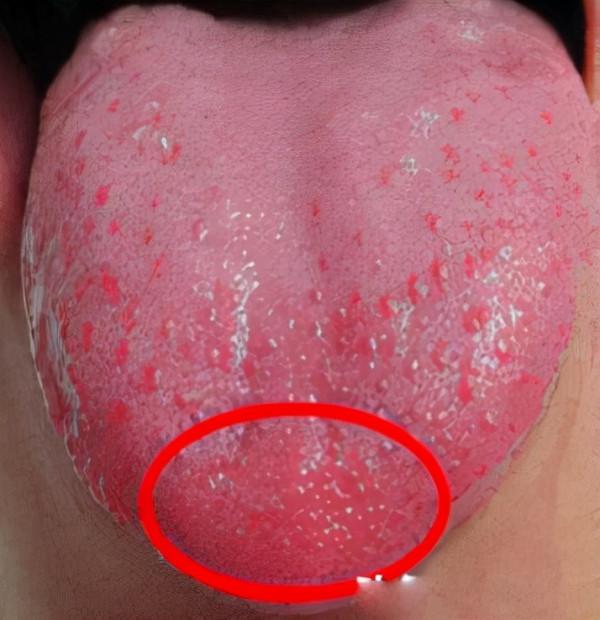 下半身怕寒、腳涼，上半身怕熱，愛上火，可能是上熱下寒了