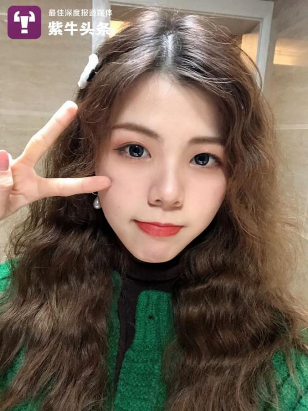 24歲女生抗癌一年：做3次化療30多次放療 脖子潰爛