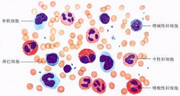 血常規檢查化驗單怎麼看?醫生:並不是有箭頭就不正常 血常規檢查化驗單怎麼看?醫生:並不是有箭頭就不正常