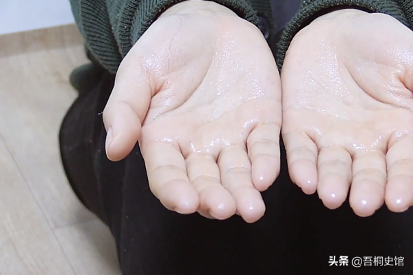 韓國女子每天汗流不止,出門需換3身衣服25雙襪子,生活面臨困擾 韓國女子每天汗流不止,出門需換3身衣服25雙襪子,生活面臨困擾