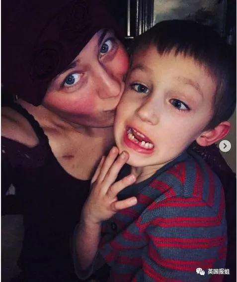 27歲網紅去世面板出狀況沒管三年後癌症晚期？