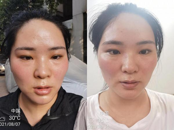 減肥可以吃麻辣燙嗎?已經瘦了二十多斤的小慧告訴你答案 減肥可以吃麻辣燙嗎?已經瘦了二十多斤的小慧告訴你答案