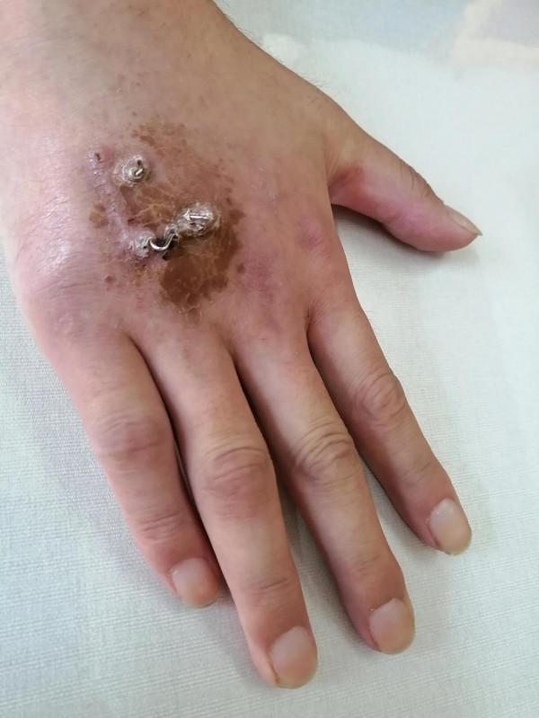 面板病很多種，誰又能夠分的清？