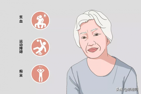 下肢無力,走路不穩,竟是缺了這種維生素 下肢無力,走路不穩,竟是缺了這種維生素