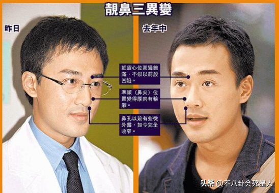 TVB藝人不愛整容，但這5位演員“換頭逆襲”，林峰、劉愷威都在列