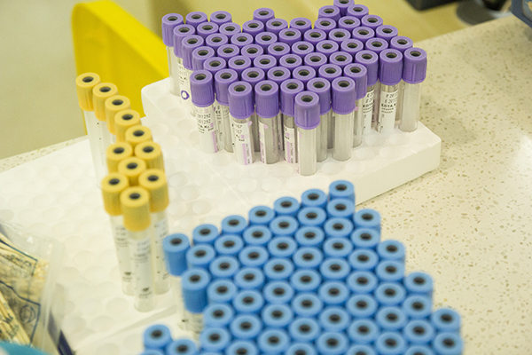 為什麼一到醫院看病就要抽血化驗?血常規檢查到底有什麼用? 為什麼一到醫院看病就要抽血化驗?血常規檢查到底有什麼用?