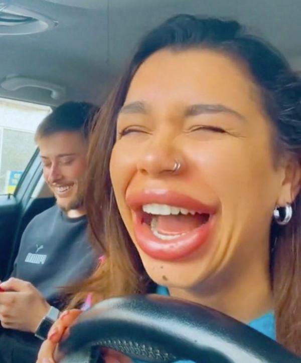 英國25歲女子後悔豐唇，為逆轉又進行溶解，男友：是什麼鬼東西？