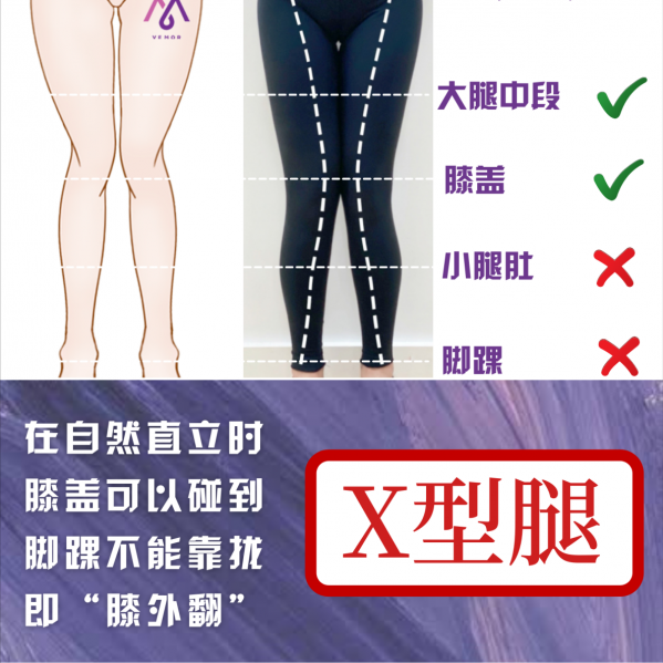 VEMOR變美乾貨｜你瞭解你的腿形嗎？