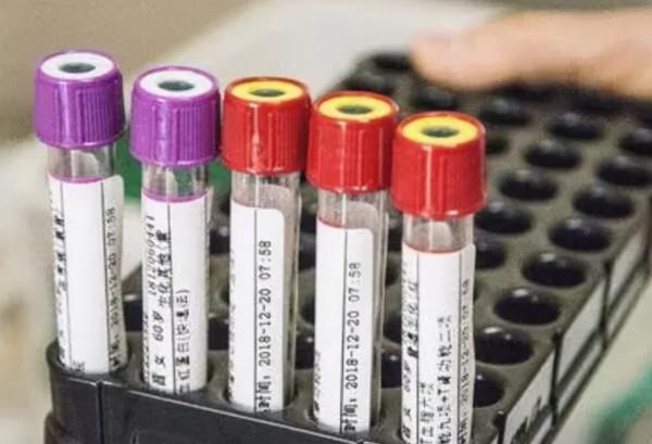 做血常規檢查，建議大家注意這3個指標，別忽視了