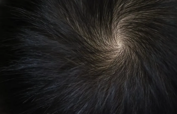 頭頂2個旋和1個旋的孩子有何不同？兩個旋更聰明？科學研究這樣說