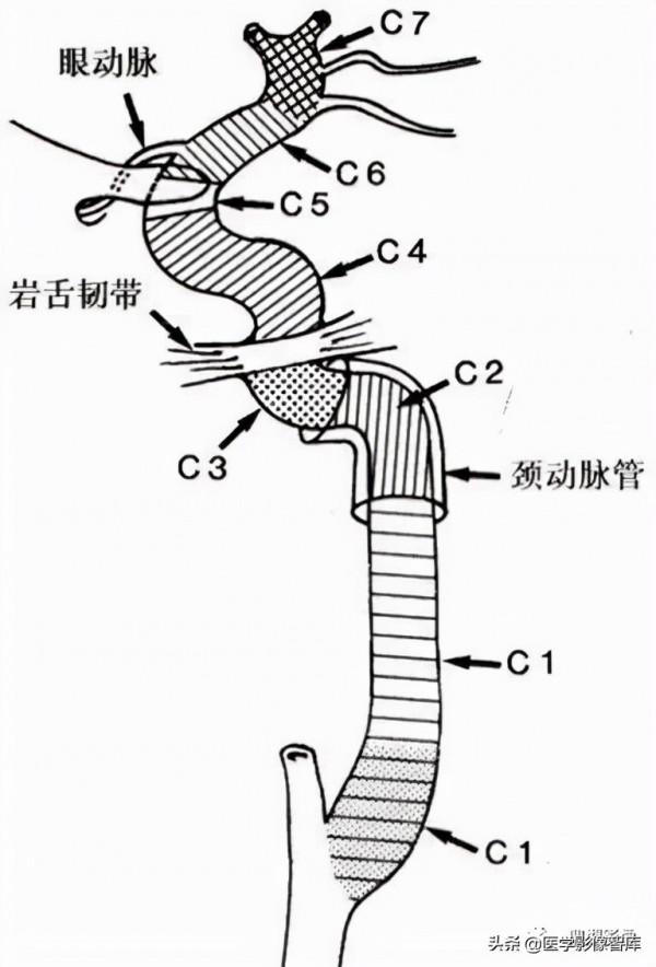 CT斷層解剖圖譜最全總結「推薦收藏」 CT斷層解剖圖譜最全總結「推薦收藏」