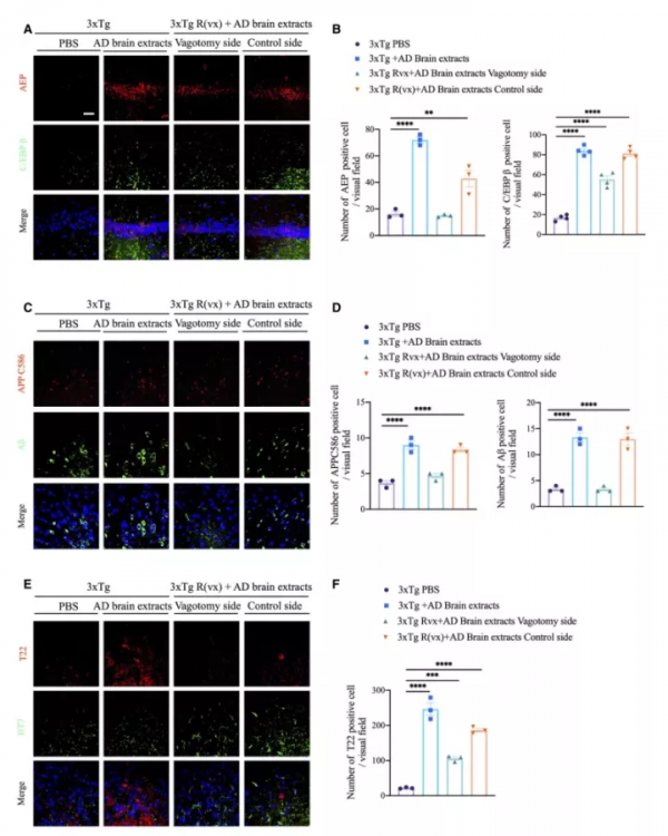 腸道炎症誘導C/EBPβ/δ分泌酶依賴性Aβ和Tau病理的對腦傳播 腸道炎症誘導C/EBPβ/δ分泌酶依賴性Aβ和Tau病理的對腦傳播