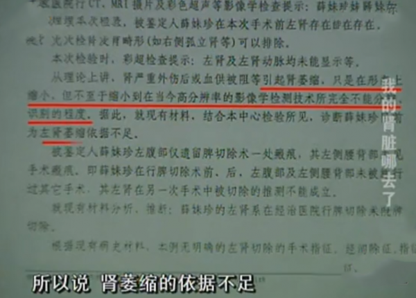 1985年，一女子做脾臟手術，10年後卻發現腎沒了，醫院：賠你20萬