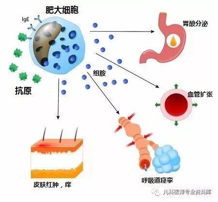 過敏和慢性面板病為啥少吃或不吃海鮮? 過敏和慢性面板病為啥少吃或不吃海鮮?