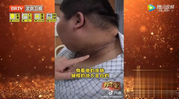 身上長出小疙瘩、紅斑，不痛不癢就沒事？警惕是惡性腫瘤潛伏體內