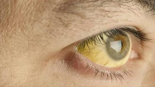 肝功能怎麼看？這三個指標需重視，如果正常說明你的肝臟很健康