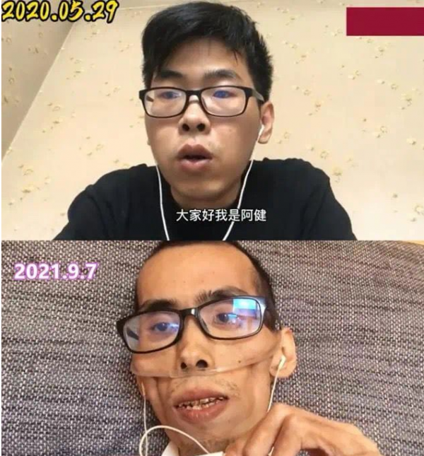 3萬元一盒藥,120萬一針,癌症什麼時候能被攻克? 3萬元一盒藥,120萬一針,癌症什麼時候能被攻克?