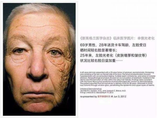 堅持做讓面板變好的小習慣