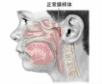 娃睡覺張嘴越長越醜？很多小孩都有的腺樣體肥大，一文說清