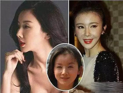 那些一刀切削骨的明星還好嗎?後遺症一大堆,小方臉成最大贏家 那些一刀切削骨的明星還好嗎?後遺症一大堆,小方臉成最大贏家