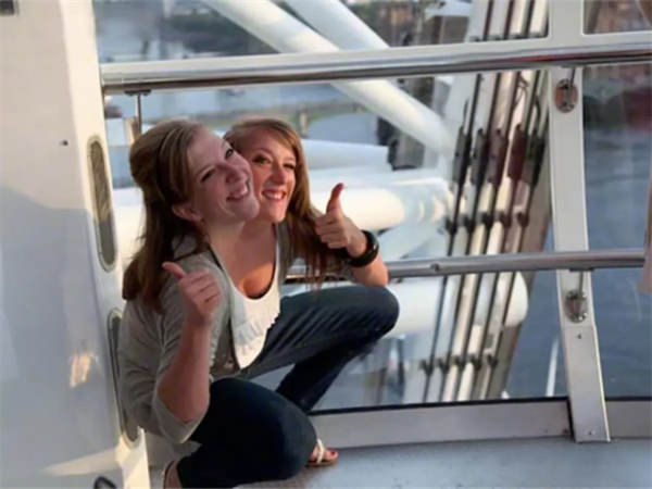 雙胞胎女嬰腹部相連醫生都說活不了，4歲做分離手術如今已滿20歲