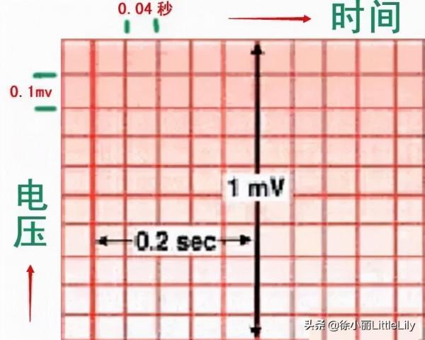 這樣教你看心電圖,沒有理由看不懂 這樣教你看心電圖,沒有理由看不懂