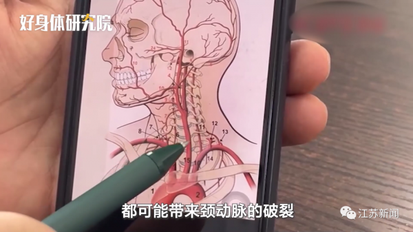 男子甩了幾下頭，竟把頸動脈甩破了！醫生：這些行為很危險