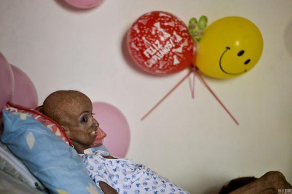 菲律賓女孩14歲參加選美，2年內滿臉皺紋，外表像60歲比她媽還老