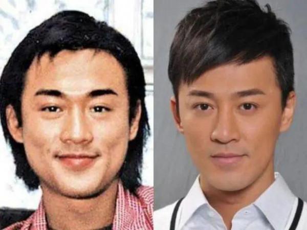 越整越難看後遺症一堆的男星：臉像鞋拔子，不能做表情，演戲難看