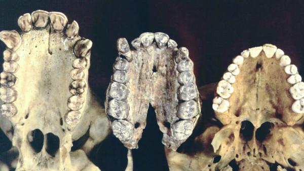 人類仍在進化！2020年研究：手臂長出新血管，會永久進化嗎？