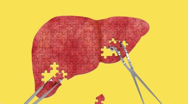 慢性肝病的8大常見體檢發現，是什麼原因引起的？醫生告訴你