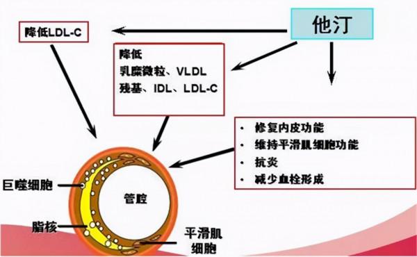 頸動脈有斑塊，會有哪些症狀？應該如何治療？醫生告訴你答案