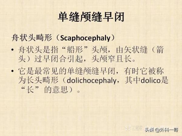 小兒顱縫早閉的診斷治療