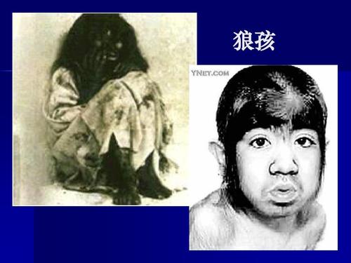 罕見！印度一個女嬰被流浪狗“撫養”，“狗孩”究竟靠不靠譜？