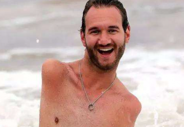 1982年，那個天生沒有四肢的澳大利亞男子尼克&CenterDot;胡哲，後來怎樣了