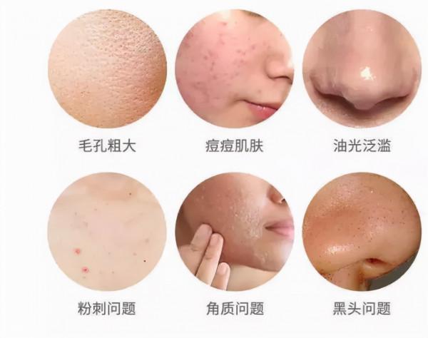 拒絕“無效護膚”!這10個護膚技巧你get到了麼? 拒絕“無效護膚”!這10個護膚技巧你get到了麼?