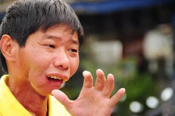 國家對檳榔“下狠手”!一包賣到100元的檳榔,對國人危害多大? 國家對檳榔“下狠手”!一包賣到100元的檳榔,對國人危害多大?