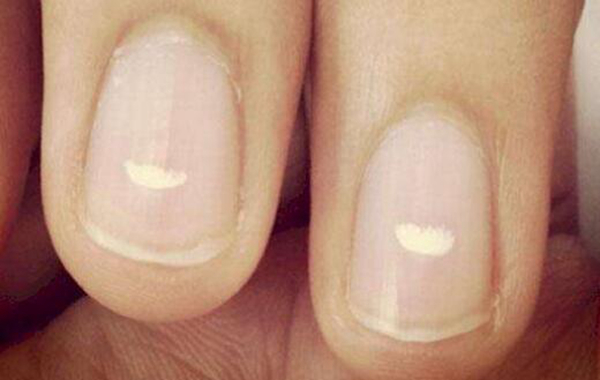 指甲上的月牙越大、越多，身體就越好？真相可能不是你想的那樣