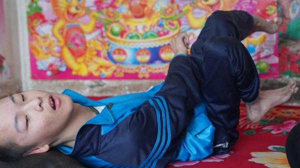 15歲男孩身患重症，被醫生宣判“無期徒刑”，全家人苦盼奇蹟發生