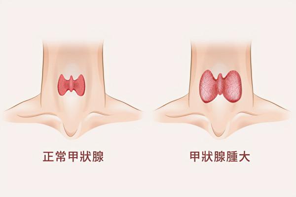 為什麼有的人愛出汗？醫生：原因無外乎這3點，多留點心