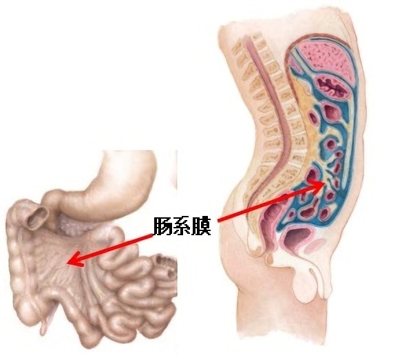 孩子慢性腹痛的背鍋俠——腸繫膜淋巴結炎 孩子慢性腹痛的背鍋俠——腸繫膜淋巴結炎