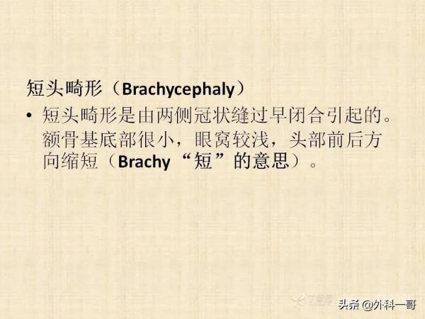 小兒顱縫早閉的診斷治療