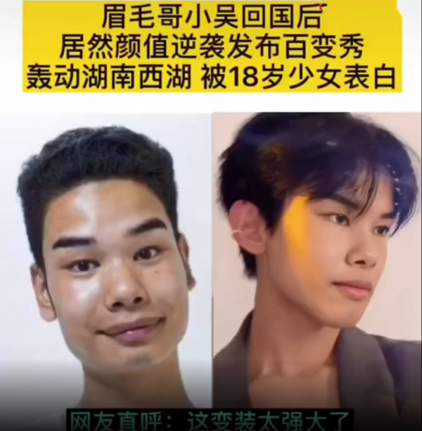 因眉毛走紅的小吳,去了趟韓國回來後大變樣,這是“換頭”了嗎? 因眉毛走紅的小吳,去了趟韓國回來後大變樣,這是“換頭”了嗎?