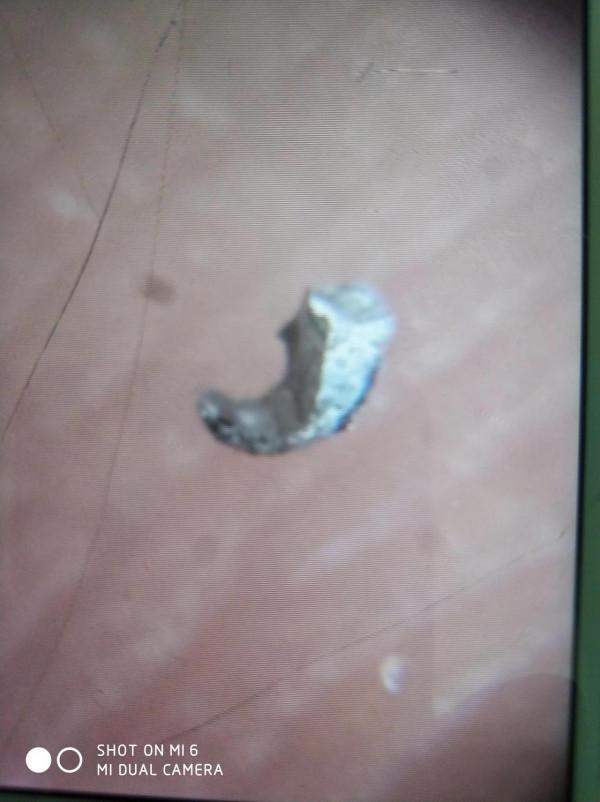 石隕石身上脫落的單質鐵鎳金屬顆粒形狀如何? 石隕石身上脫落的單質鐵鎳金屬顆粒形狀如何?