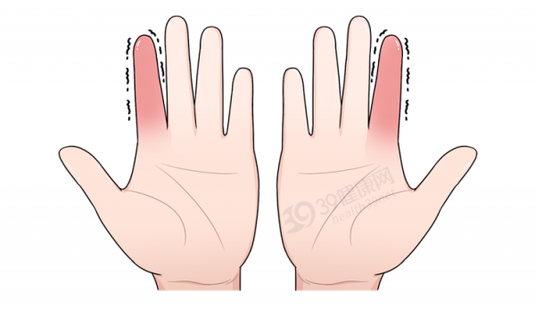 身體好不好，看手就知道？一文教你從手上看出身體狀況，附對比圖